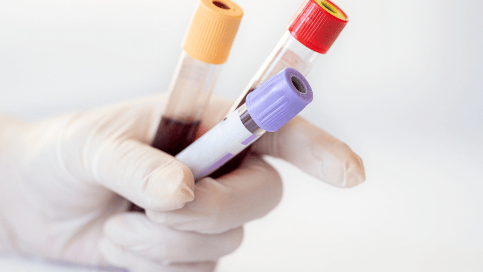 Encontre o exame toxicológico mais rápido em Vila Velha. Agende no Laboratório Nossa Rede e obtenha resultados com rapidez e segurança.