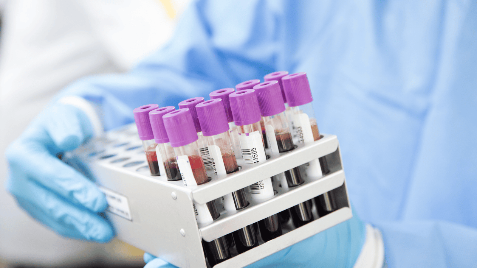 Onde fazer exame toxicológico em Linhares? Agende seu exame no Laboratório Nossa Rede com rapidez, segurança e resultados precisos.
