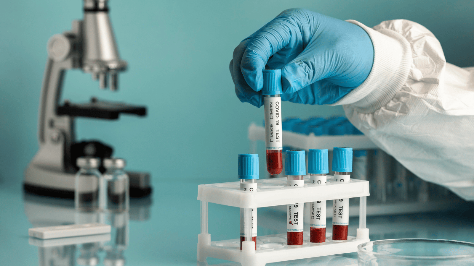 Melhor preço de exame toxicológico em Serra. Agende no Laboratório Nossa Rede com rapidez, segurança e valores acessíveis.