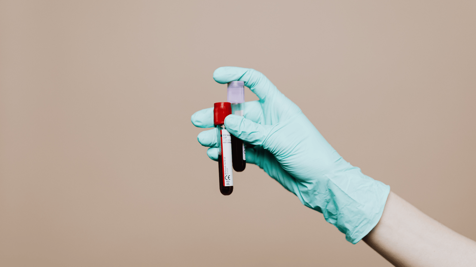 Onde fazer exame toxicológico em Viana? Agende no Laboratório Nossa Rede com resultados rápidos, seguros e precisos.